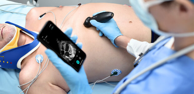TE Air Echo i3p Wireless Handheld Ultrasound
